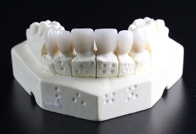 tooth-replacement-759929_640.jpg www.pixabay.com